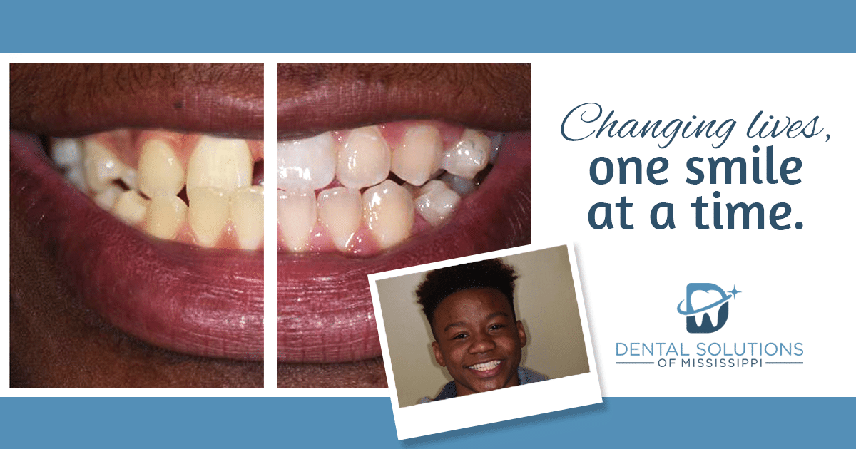 changing lives one smile at a time in canton MS Dental Solutions of Mississippi dentist in Canton MS Dr. Ruth Roach Morgan Dr. Jessica Morgan