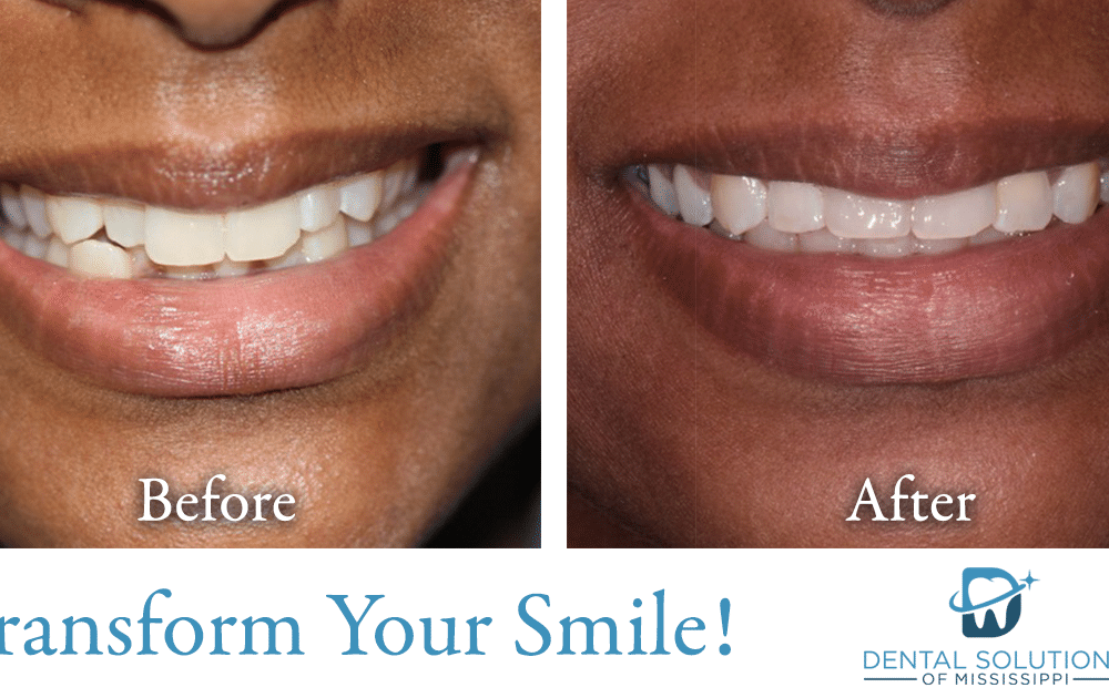 Before and after dental treatment Dental Solutions of Mississippi dentist in Canton MS Dr. Ruth Roach Morgan Dr. Jessica Morgan