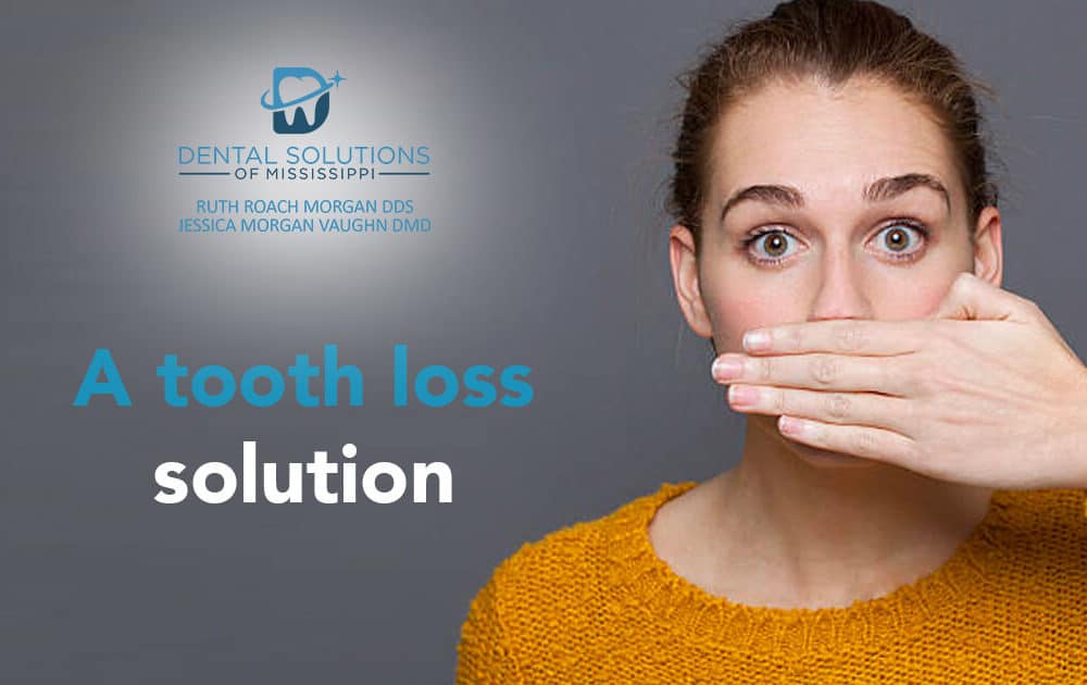 A tooth loss solution Dental Solutions of Mississippi dentist in Canton MS Dr. Ruth Roach Morgan Dr. Jessica Morgan