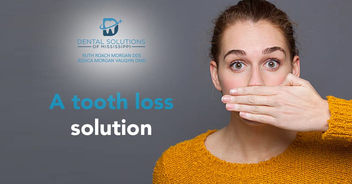 A tooth loss solution Dental Solutions of Mississippi dentist in Canton MS Dr. Ruth Roach Morgan Dr. Jessica Morgan