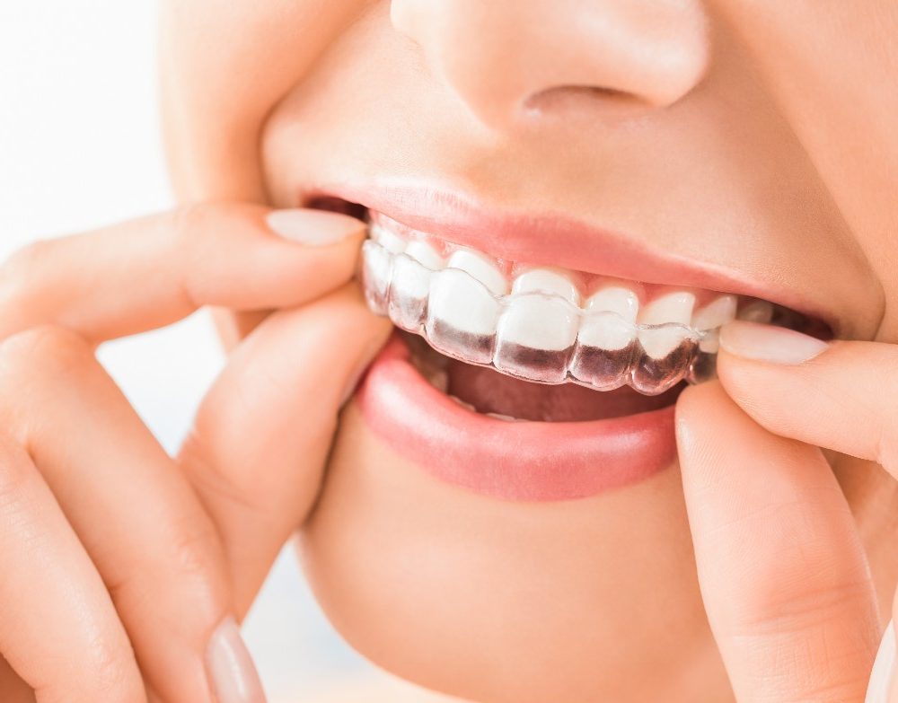 Straightening Your Smile With Invisalign Invisalign in Canton. Dental Solutions of Mississippi. General, Cosmetic, Restorative Dentist in Canton, MS 39046 Call: 601-859-2182 Invisalign Dental Solutions of Mississippi dentist in Canton MS Dr. Ruth Roach Morgan Dr. Jessica Morgan