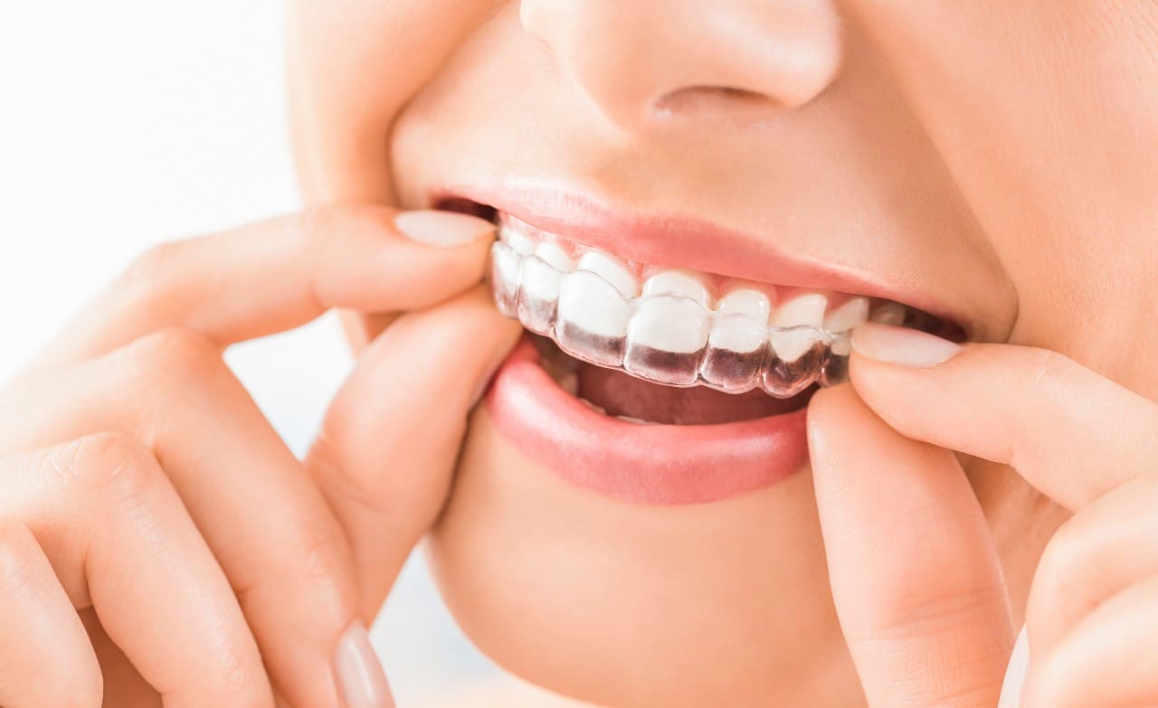 Straightening Your Smile With Invisalign Invisalign in Canton. Dental Solutions of Mississippi. General, Cosmetic, Restorative Dentist in Canton, MS 39046 Call: 601-859-2182 Invisalign Dental Solutions of Mississippi dentist in Canton MS Dr. Ruth Roach Morgan Dr. Jessica Morgan